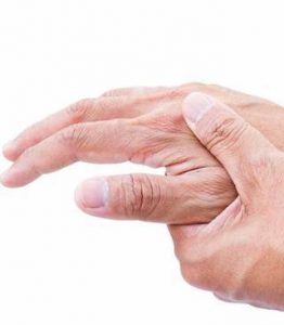Hands demonstrating possible symptoms of rheumatology issues, relevant to Noydeen Medical Group's rheumatology services.